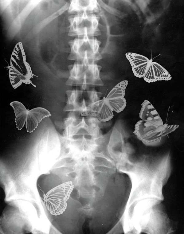 butterflies.jpg